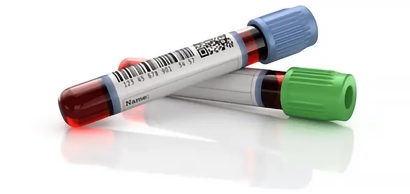 blood-test-tubes-800